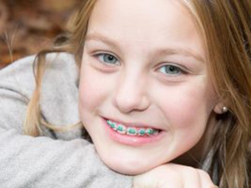 Featured image for “Facts to Consider When Choosing a Dental Bridge”