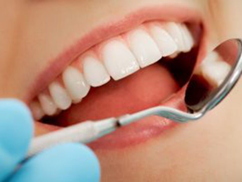 Featured image for “Best Quality Dental Veneers in Phoenix”