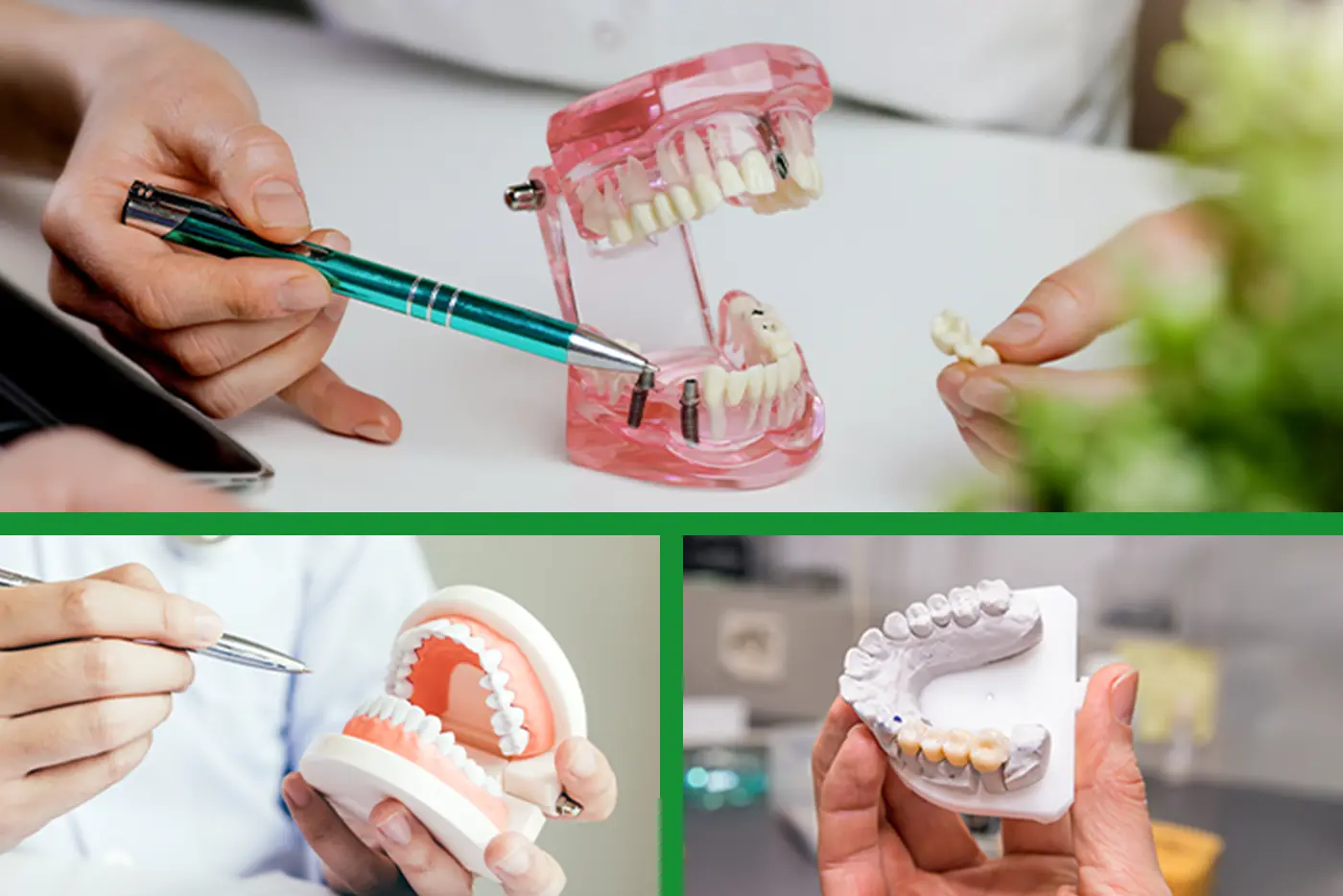 Featured image for “Dental Implant vs. Bridge vs. Dentures: Choosing the Best Tooth Replacement”