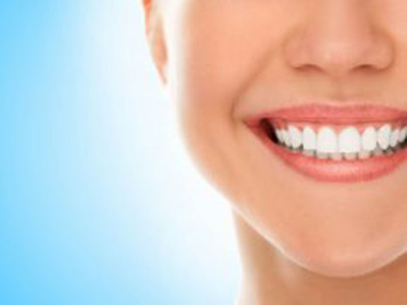 Featured image for “Smile Brightening Is Popular for Many Good Reasons”