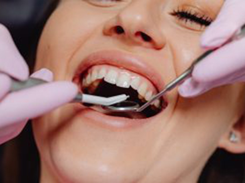 dental treatment