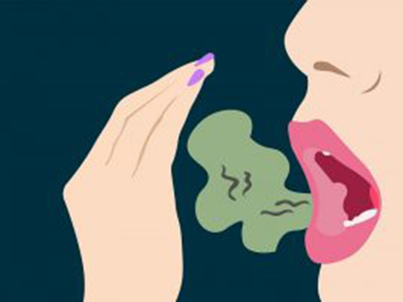 Featured image for “What Is Halitosis?”