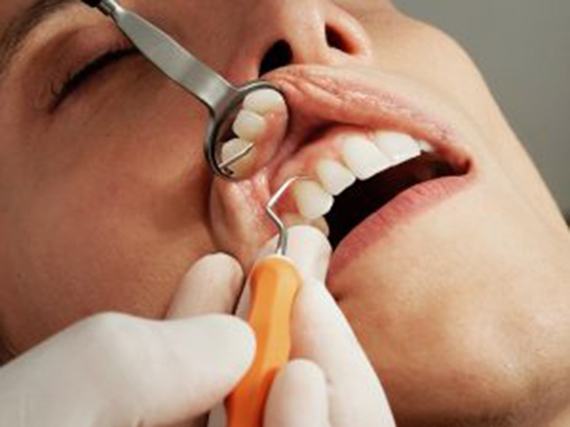 Dental Examination in Phoenix, AZ