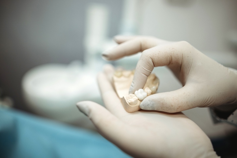 Middle-aged woman smiling after getting dental implants in Phoenix, AZ
